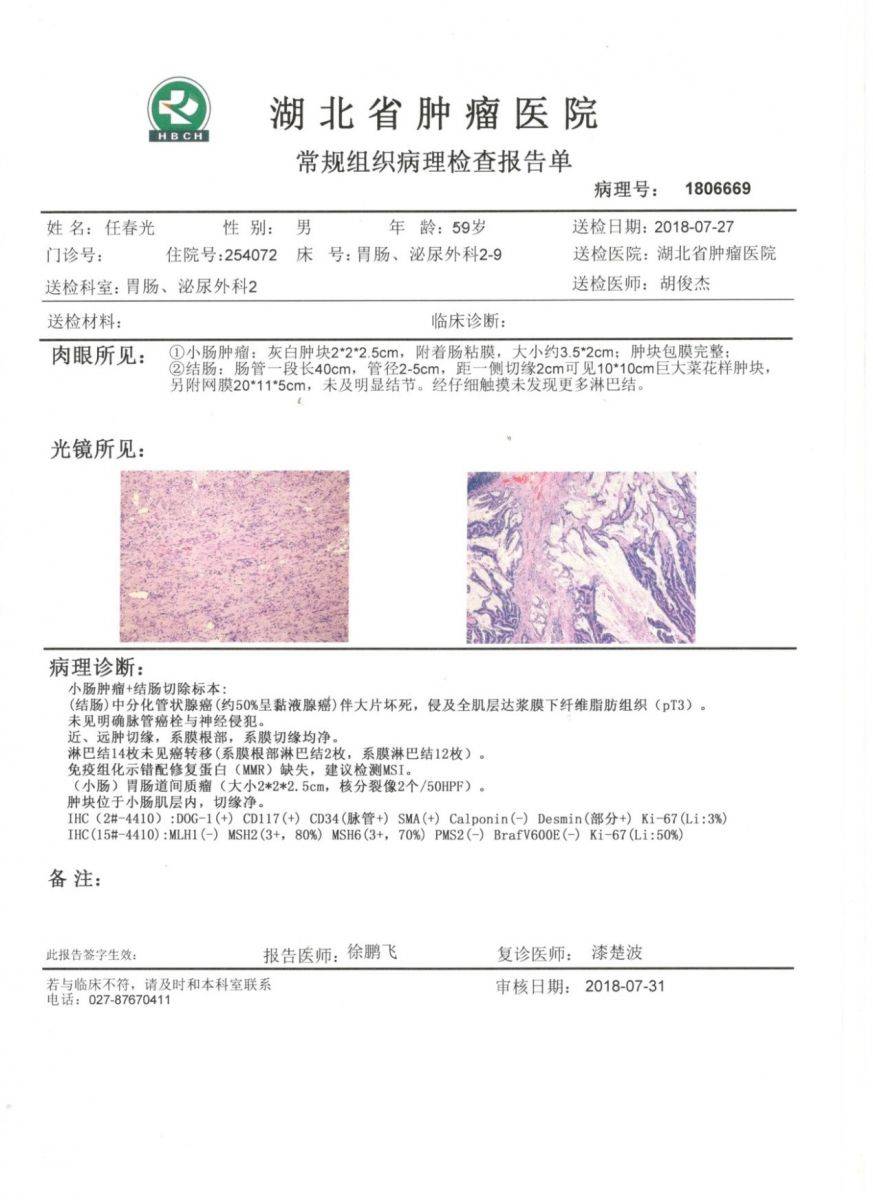 常规组织病理检查报告单_典型病例_湖北省肿瘤医院