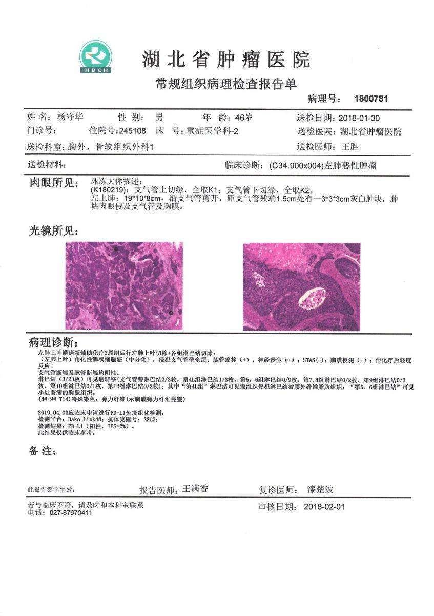 病理报告是什么样子图片