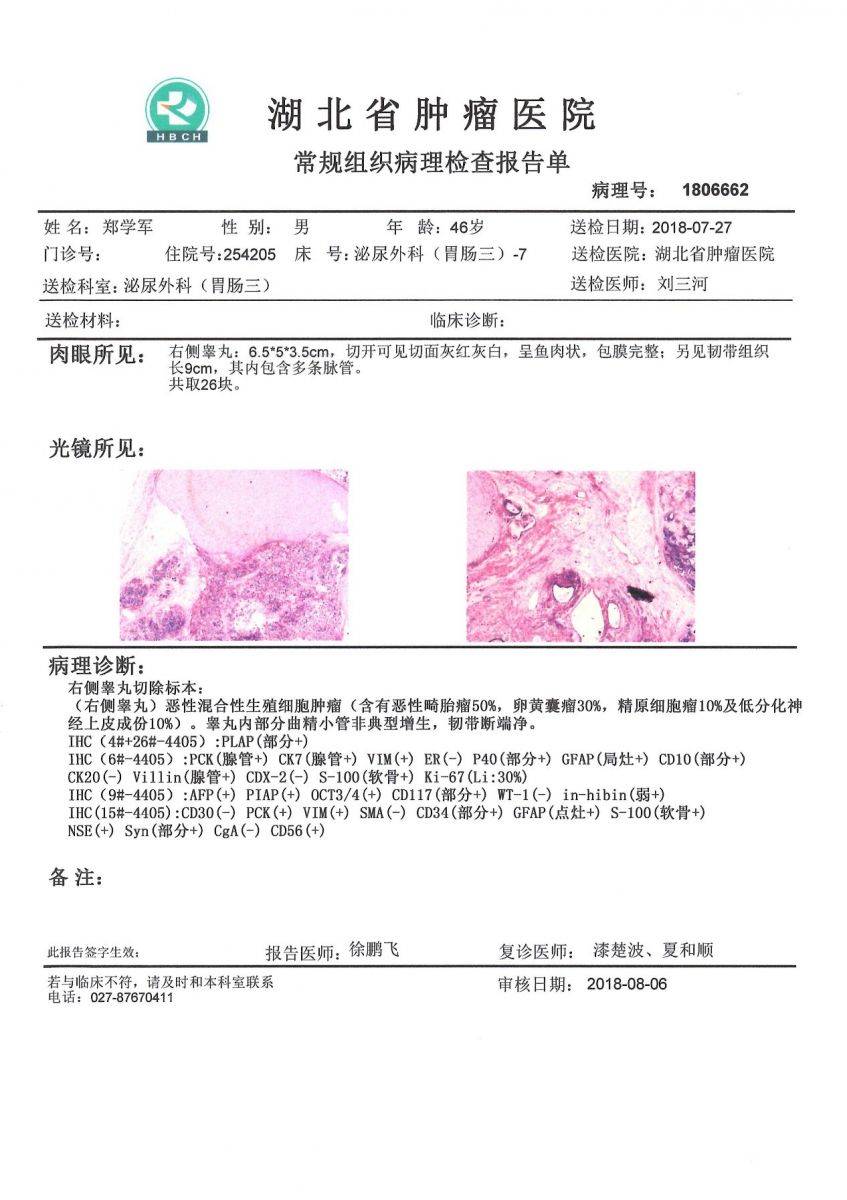 病理报告什么样子图片图片